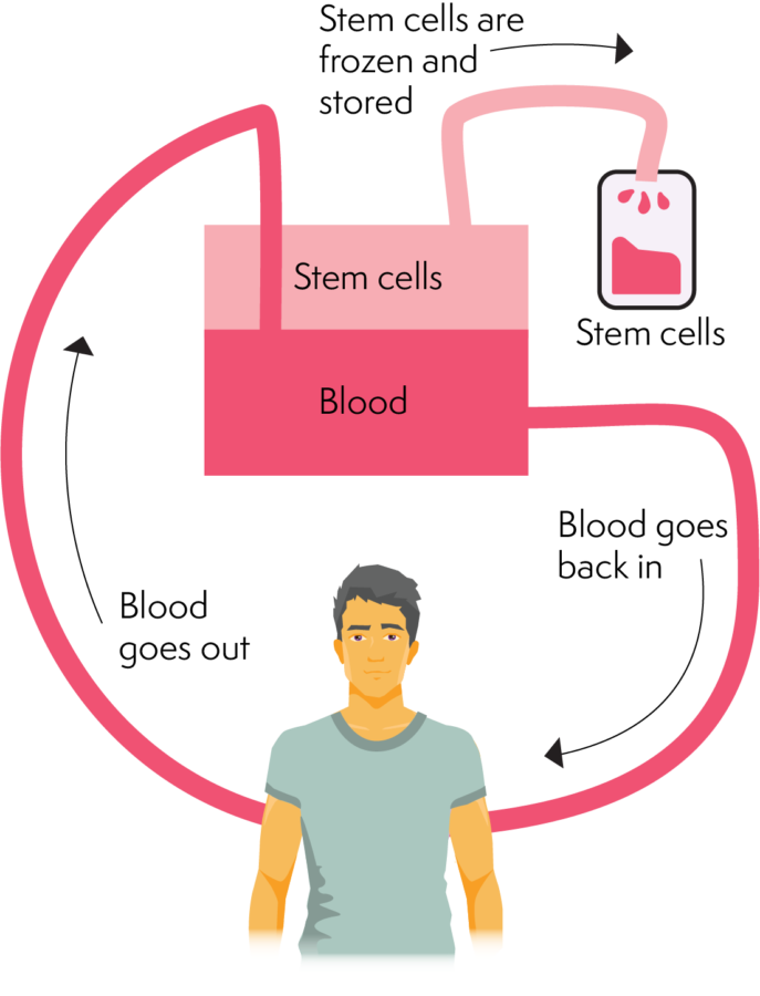 Autologous Stem Cell Transplant Lymphoma Australia - Vaccination Schedule After Autologous Stem Cell Transplant