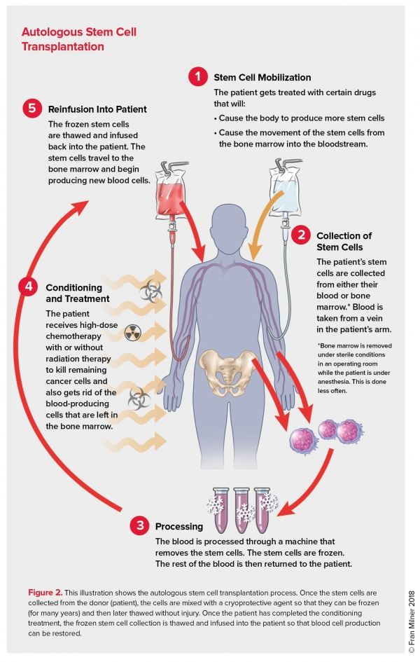 Autologous Stem Cell Transplantation Leukemia And Lymphoma Society - Vaccination Schedule After Autologous Stem Cell Transplant