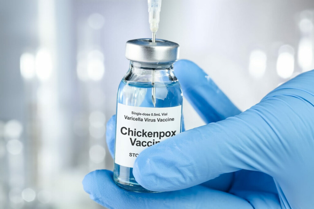 Chickenpox Vaccine For Children Childhealthy London - Chicken Pox Vaccination Schedule