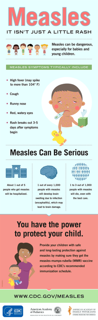 Measles Isn t Just A Little Rash Infographic Measles Rubeola CDC - Measles Vaccine Schedule For Infants