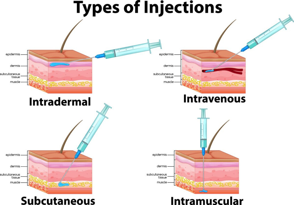 Only Skin Deep The Pharmacist s Guide To Intradermal Vaccine  - Intradermal Rabies Vaccine Schedule